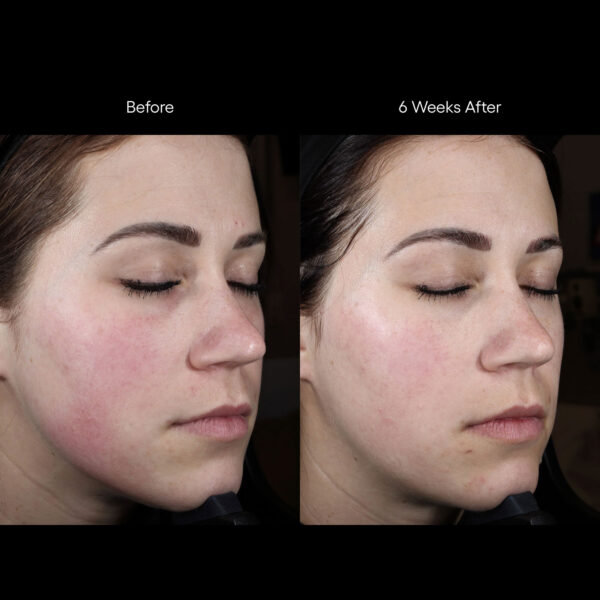 Rion ( plated )™ Skin Science INTENSE Serum - Image 5