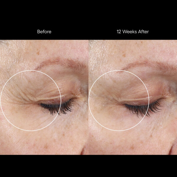 Rion ( plated )™ Skin Science INTENSE Serum - Image 3