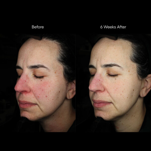 Rion ( plated )™ Skin Science INTENSE Serum - Image 4