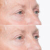 Soke Advanced Firming Eye Treatment - Image 2