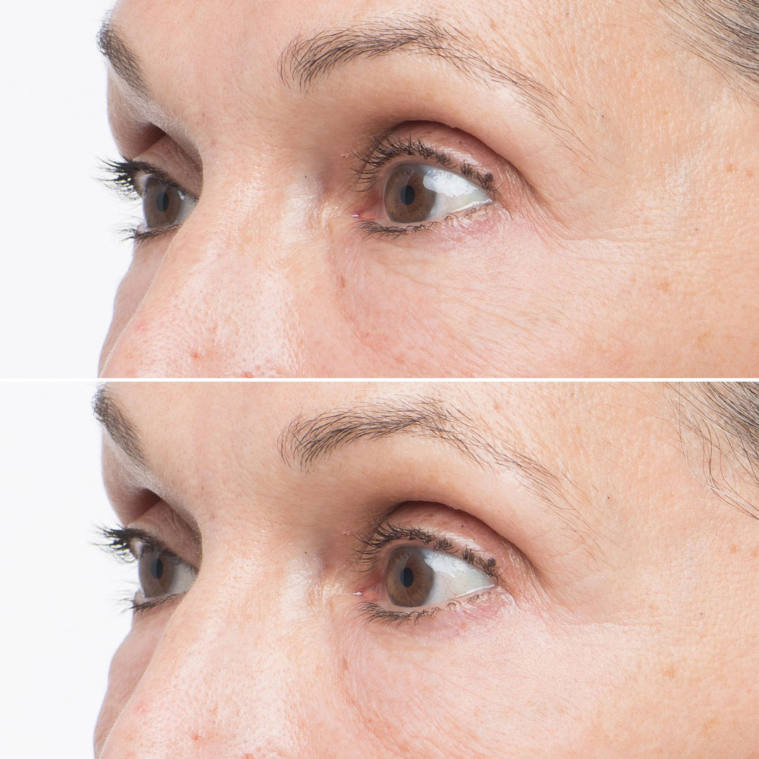 Soke Advanced Firming Eye Treatment - Image 3