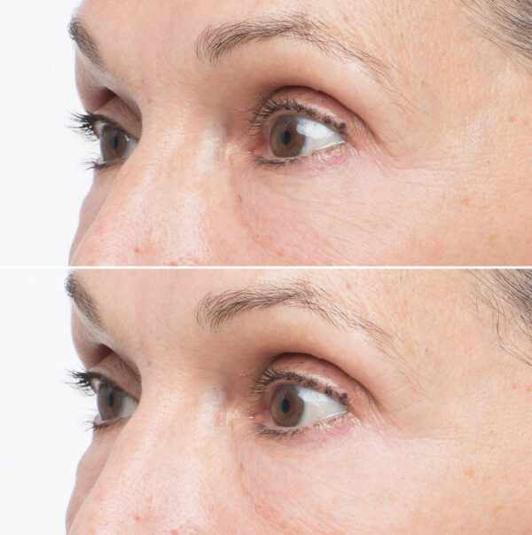 Soke Advanced Firming Eye Treatment - Image 3