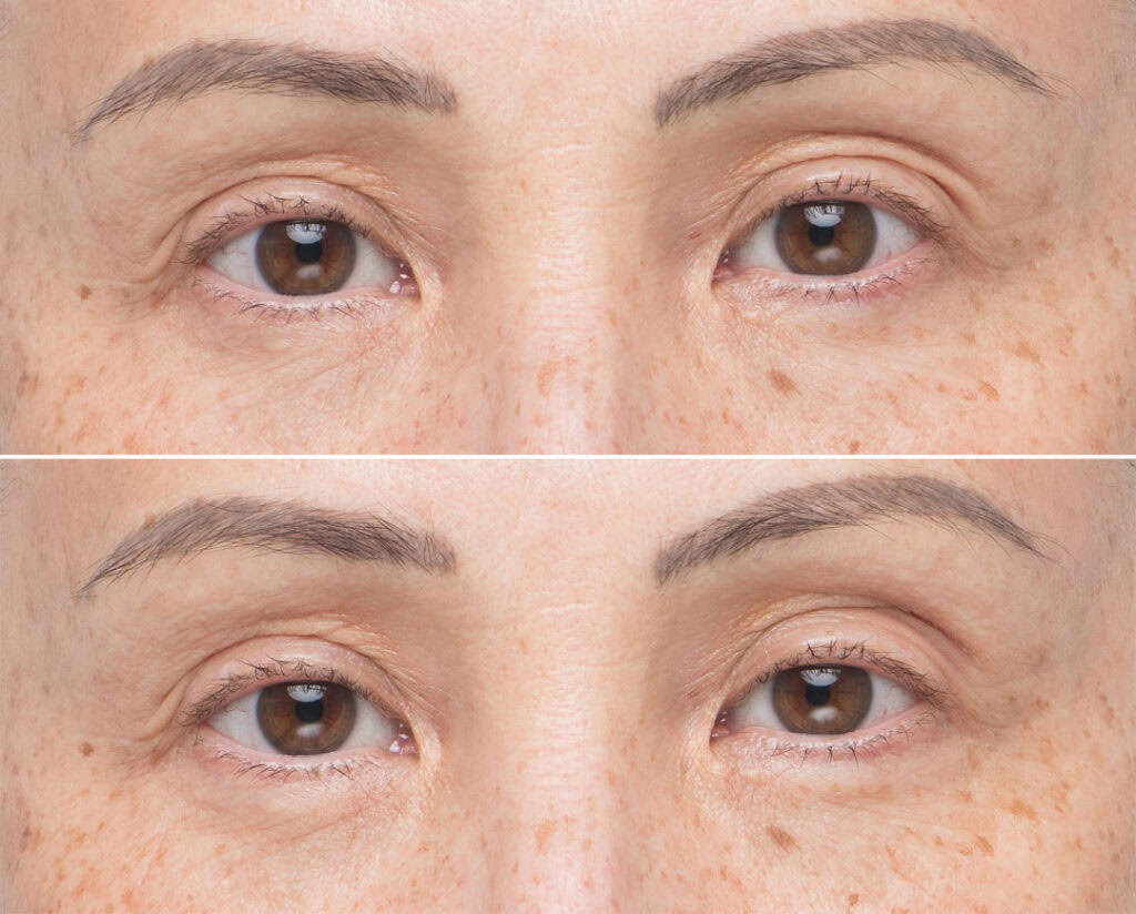 Soke Advanced Firming Eye Treatment Custom Skincare Shop at Toronto