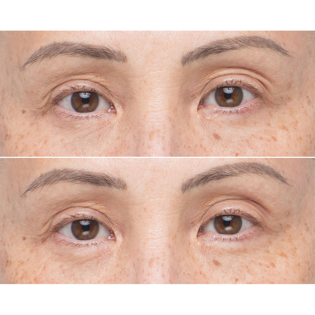 Soke Advanced Firming Eye Treatment - Image 5