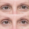 Soke Advanced Firming Eye Treatment - Image 5