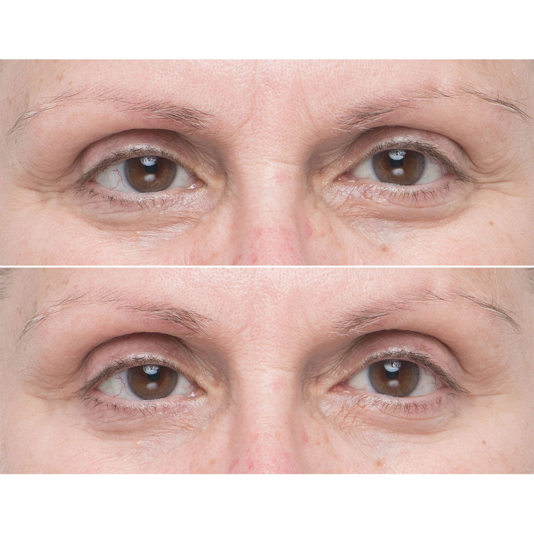 Soke Advanced Firming Eye Treatment - Image 6