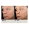 SkinMedica TNS Advanced+ Serum - Image 2