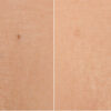 Soke Deep Hydration + Multi Peptide Treatment for the Chest/Decolletage - Image 5