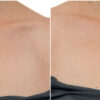 Soke Deep Hydration + Multi Peptide Treatment for the Chest/Decolletage - Image 4