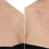 Soke Deep Hydration + Multi Peptide Treatment for the Chest/Decolletage - Image 3